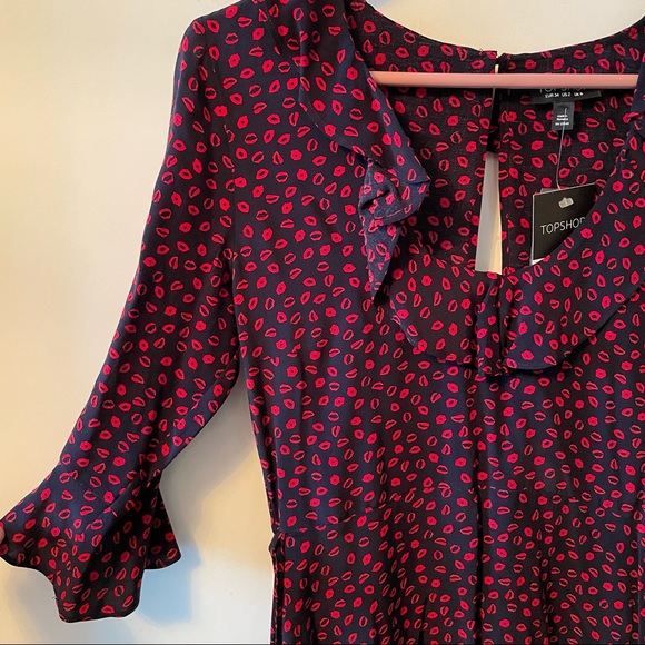 NWT TopShop Lip Print Open Back Dress - Picture 2 of 8